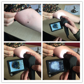 المهنية فيديو الجلد Dermatoscope المفتش مع بطاقة مايكرو التنمية المستدامة