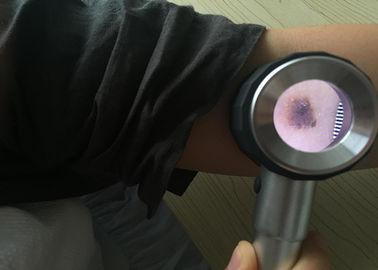 مخصص الرعاية الصحية المحمولة الطبية Dermatoscope الفيديو الرقمي منظار الأذن لتفتيش الجلد