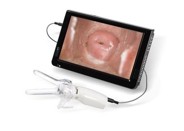 Mini Colposcope for Examintion Vaginal Cervical Camera متصلة مع التلفزيون أو الكمبيوتر الشخصي