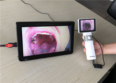 منظار الأذن المحمولة منظار العين فيديو الحلق Dermatoscope مع إخراج بطاقة SD للعيادة