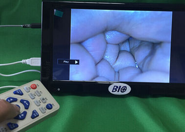 إخراج الفيديو الكامل الرقمية منظار المهبل كاميرا أمراض النساء مع دليل المستخدم