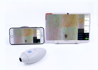 HD فيديو رقمي Dermatoscope ماسحة شعر لاسلكية متصلة بشركة Mobilophone المدعومة IOS Andriod