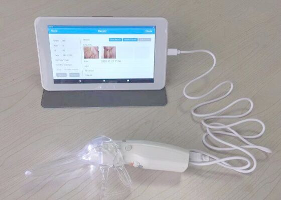 منظار المهبل الفيديو الرقمية لرعاية المرأة 10 أو 7 بوصة مراقبة الطبية كاميرا المهنية لفحص عنق الرحم