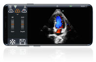 اللون اللاسلكية المحمولة الموجات فوق الصوتية التحقيق مسبار الرقمية الموجات فوق الصوتية محول القلب
