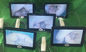 منظار المهبل الفيديو الرقمية لرعاية المرأة 10 أو 7 بوصة مراقبة الطبية كاميرا المهنية لفحص عنق الرحم