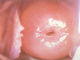 محمول عنق الرحم كاميرا رقمية منظار المهبل لأمراض النساء لفحص عنق الرحم مع 80،0000 بكسل القرار 1 ~ 128 تكبير