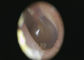 فحص الأنف والأذن والحنجرة السريري لجسم منظار الأذن للفيديو الرقمي بجسم الإنسان مع منظار TFT LCD USB ذو لون ملون