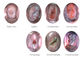 صدى عالية الوضوح - منظار المهبل الرقمية الالكترونية أمراض النساء جهاز منظار المهبل
