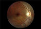منظار العين بالفيديو الطبي التركيز التلقائي مع مجال الرؤية 45 درجة