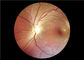 منظار العين بالفيديو الطبي التركيز التلقائي مع مجال الرؤية 45 درجة