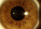معدات طب العيون المحمولة الرقمية غير Mydryatic