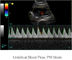 باد جهاز التشخيص بالموجات فوق الصوتية الماسح الضوئي بالموجات فوق الصوتية المحمولة مع 500G صورة التخزين