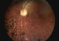 3.5 &quot;معدات تشخيص أمراض العيون لمرض السكري الجلوكوما