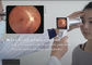 معدات تشخيص قاع العين الرقمية لأمراض قاع العين