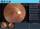 3.5 بوصة تعمل باللمس الطبية الرقمية نظام طب العيون الرقمية قاع الكاميرا مرفق الرؤية الأمامية المتاحة