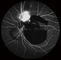 متحد البؤر Retina Opthalmoscope Digital قاع الكاميرا مع FOV 15 ° ، 30 ° ، 60 ° حجم الصورة 1024 * 1024