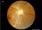 طب وجراحة العيون الطبية المحمولة معدات كاميرا قاع العين