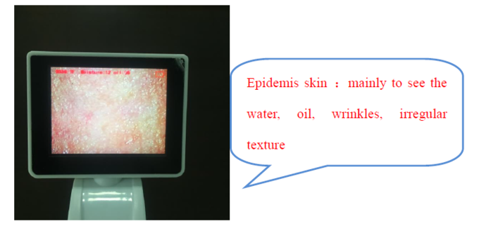 CE BS5SH الرقمية محلل الجلد الرقمية الجلد الرطوبة متر للطبيب