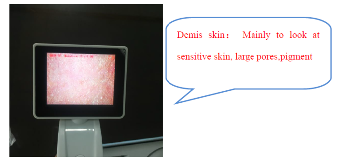CE BS5SH الرقمية محلل الجلد الرقمية الجلد الرطوبة متر للطبيب