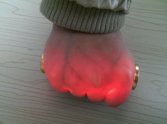 المحمولة الأوعية الدموية العارض الوريد بالأشعة تحت الحمراء الوريد الباحث الوريد محدد الذهبي الألومنيوم