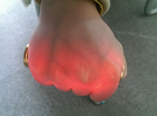 المحمولة الأوعية الدموية العارض الوريد بالأشعة تحت الحمراء الوريد الباحث الوريد محدد الذهبي الألومنيوم