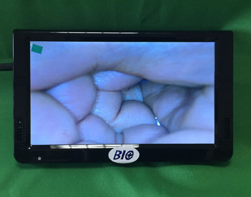 منظار المهبل الإلكتروني الرقمي المحمول