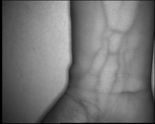 عالية الدقة 800X480 الجدول نوع الوريد محدد الجهاز مع شاشة 3.5 بوصة لليد الذراع الساق