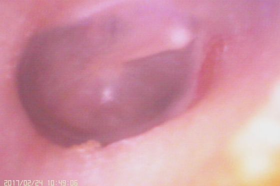 منظار الأذن الرقمي 720 × 480