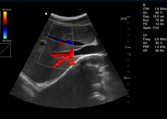 15 بوصة كامل اللون الرقمية آلة دوبلر المحمولة التصوير بالموجات فوق الصوتية دوبلر مع 2 منفذ USB