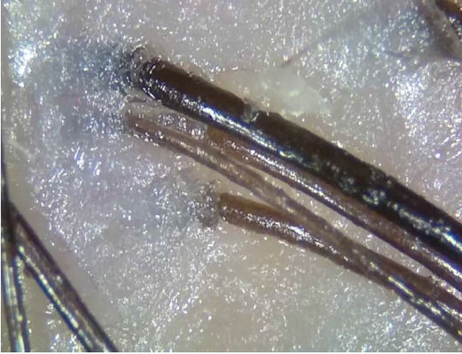 المحمولة اللاسلكية الرقمية محلل الجلد جهاز تشخيص التطبيب عن بعد مع الضوء الاستقطاب