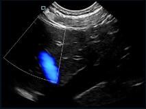 جهاز تصوير بالموجات فوق الصوتية