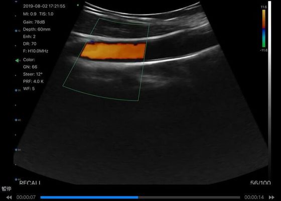 ماسح الصوت بالموجات فوق الصوتية الرقمية اللاسلكية