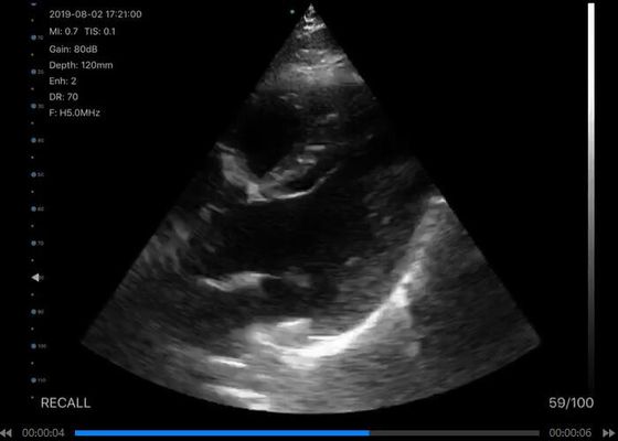 ماسح الصوت بالموجات فوق الصوتية الرقمية اللاسلكية