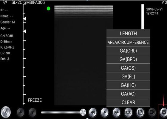 5G ماسح ضوئي محمول باليد بالموجات فوق الصوتية محدب: 3.5 ~ 5 ميجا هرتز ، خطي: ​​7.5 ~ 10 ميجا هرتز ، القلب: 2.5 ~ 5 ميجا هرتز