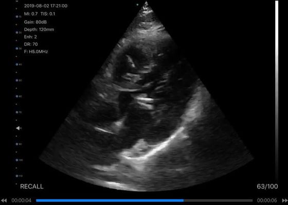 5G ماسح ضوئي محمول باليد بالموجات فوق الصوتية محدب: 3.5 ~ 5 ميجا هرتز ، خطي: ​​7.5 ~ 10 ميجا هرتز ، القلب: 2.5 ~ 5 ميجا هرتز