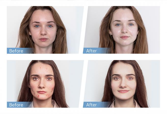 بيع مصنع قلم هيدرا H5 EMS الكهربائي قلم الإبرة الصغيرة لتكوين الكولاجين إعادة نمو شعر اللحية إعادة نمو المنزل والاستخدام في الصالون 4