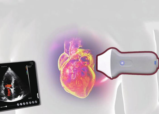 ماسح الموجات فوق الصوتية المحمولة اللاسلكية واي فاي PDI 128 عنصر